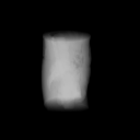 Initial prediction at 0 degrees. CT-derived simulated radiograph, displayed at the recorded common window.