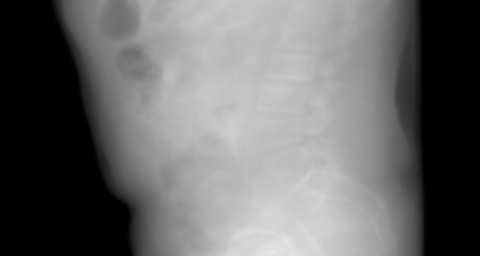 Right-to-left lateral primary projection of the synthetic chest candidate. The beam travels right → left.