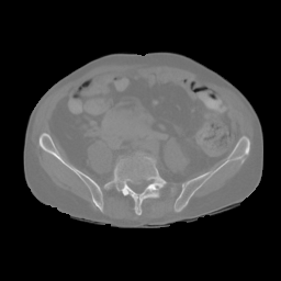 Actual middle axial slice of the synthetic pelvic CT. Top A, left L.