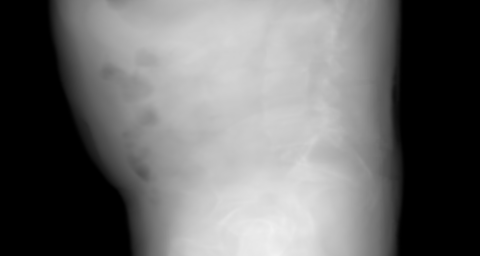 Right-to-left lateral primary projection of the synthetic pelvis candidate. The beam travels right → left.