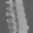 Scalar log-WLS, Broad dense, scalar attenuation at 80 kev, sagittal (x = 0 mm)