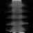 Spectral Euclidean, Broad dense, bone fraction, coronal (y = 0 mm)
