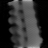 Spectral Euclidean, Broad dense, bone fraction, sagittal (x = 0 mm)