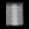 case2_dense_r0_spectral_euclidean, first whole withheld prediction, negative log over known open beam