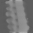 Spectral fixed metric, Broad dense, derived attenuation at 80 kev, sagittal (x = 0 mm)