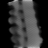 Spectral fixed metric, Broad dense, bone fraction, sagittal (x = 0 mm)