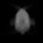 Spectral fixed metric, Limited angle, bone fraction, axial (z = 0 mm)