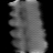 Spectral fixed metric, Limited angle, bone fraction, sagittal (x = 0 mm)