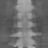 Scalar Poisson, Broad sparse, scalar attenuation at 80 kev, coronal (y = 0 mm)