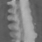 Scalar Poisson, Broad sparse, scalar attenuation at 80 kev, sagittal (x = 0 mm)