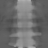 Spectral fixed metric, Broad sparse, derived attenuation at 80 kev, coronal (y = 0 mm)