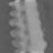 Spectral fixed metric, Broad sparse, derived attenuation at 80 kev, sagittal (x = 0 mm)