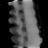 Spectral fixed metric, Broad sparse, bone fraction, sagittal (x = 0 mm)