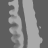 Assigned reference, scalar attenuation at 80 kev, sagittal (x = 0 mm)