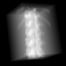 20–55 keV: generating expectation of the assigned CT-derived vertebral phantom. Lighter pixels indicate greater negative log transmission.