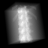 20–55 keV: simulated observation of the assigned CT-derived vertebral phantom. Lighter pixels indicate greater negative log transmission.