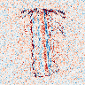 20–55 keV: observation − prediction (poisson scaled) of the assigned CT-derived vertebral phantom. Blue is negative, pale is zero and red is positive. The sign follows the panel label.
