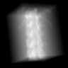 55–80 keV: generating expectation of the assigned CT-derived vertebral phantom. Lighter pixels indicate greater negative log transmission.