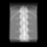 Simulated fitting radiograph 1 of the assigned phantom, 20–55 keV channel.