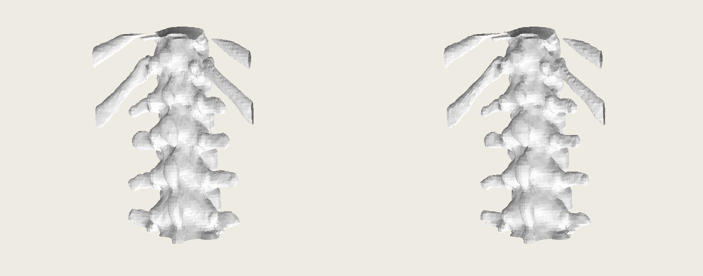 Paired unsmoothed bone surfaces: assigned CT-derived reference on the left, spectral reconstruction on the right. The vertebral column and cropped ribs are visible in both.